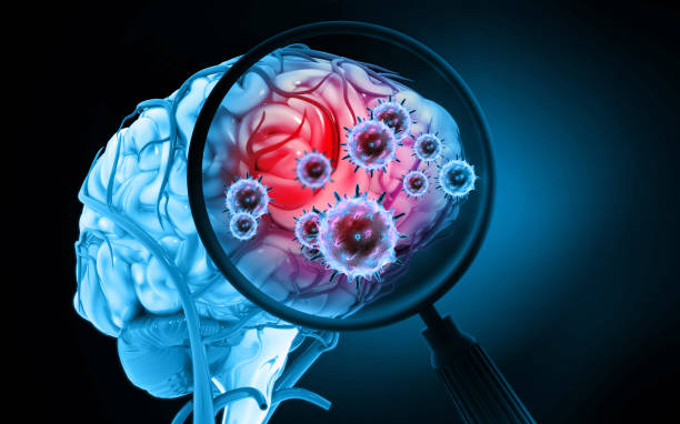 SES confirma caso de meningite meningocócica em Sergipe